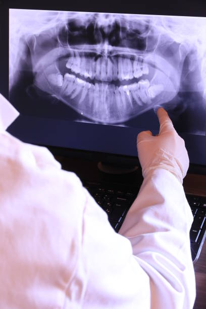 Best Emergency Care for Gum Disease in North Liberty, IA
